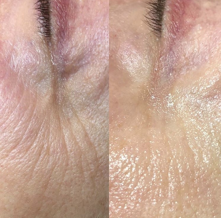 F9689DEE-5B34-461E-AFBC-115752AC390B